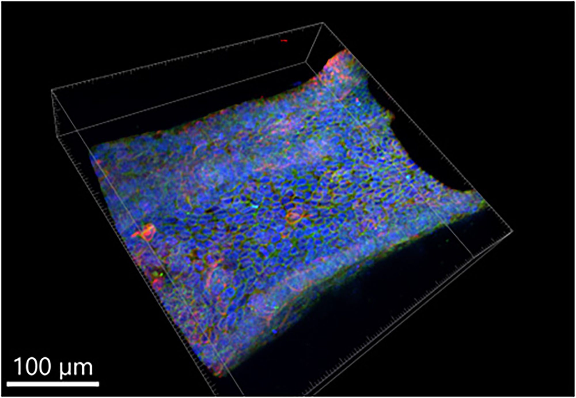 3D reconstruction of one wall of a cylindrical channel of a perfusable kidney collecting duct on-chip derived from patient cells