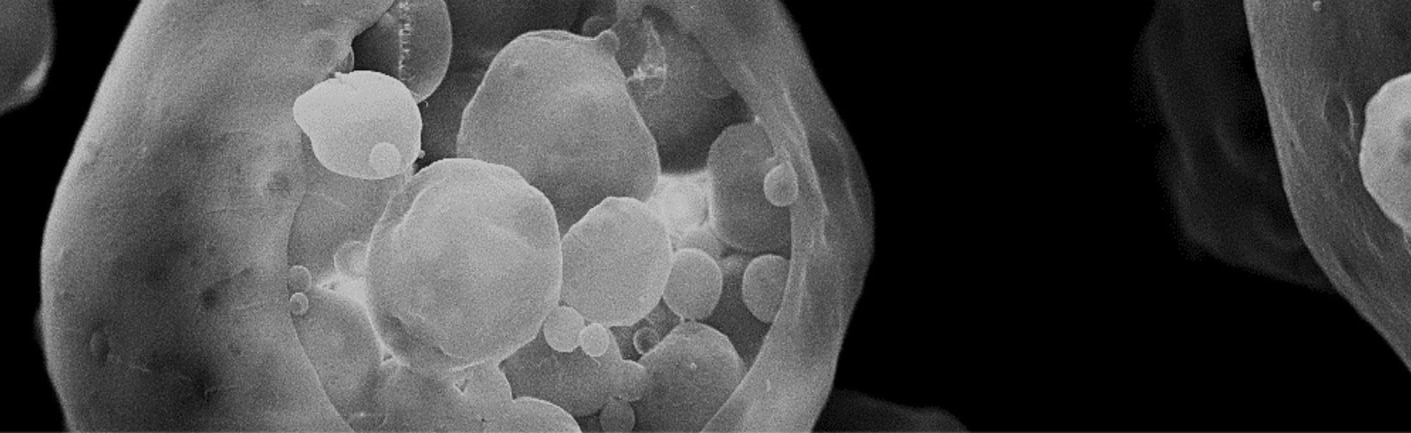 scanning electron microscope of outer membrane vesicles used for drug delivery