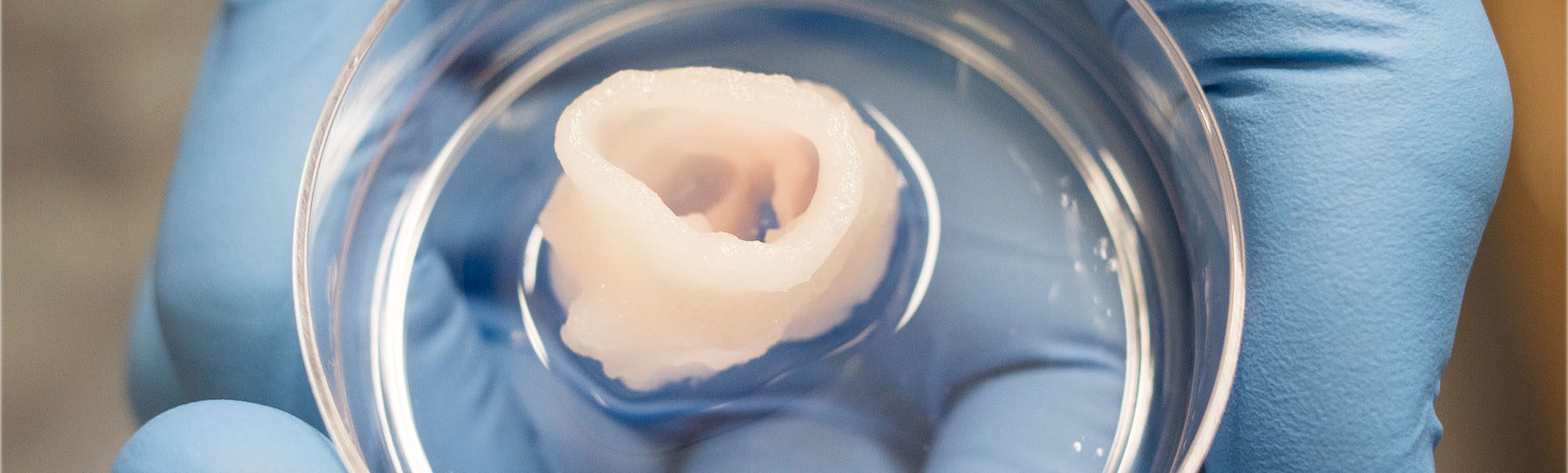 3d printed heart valve in glass petri dish in gloved hand.