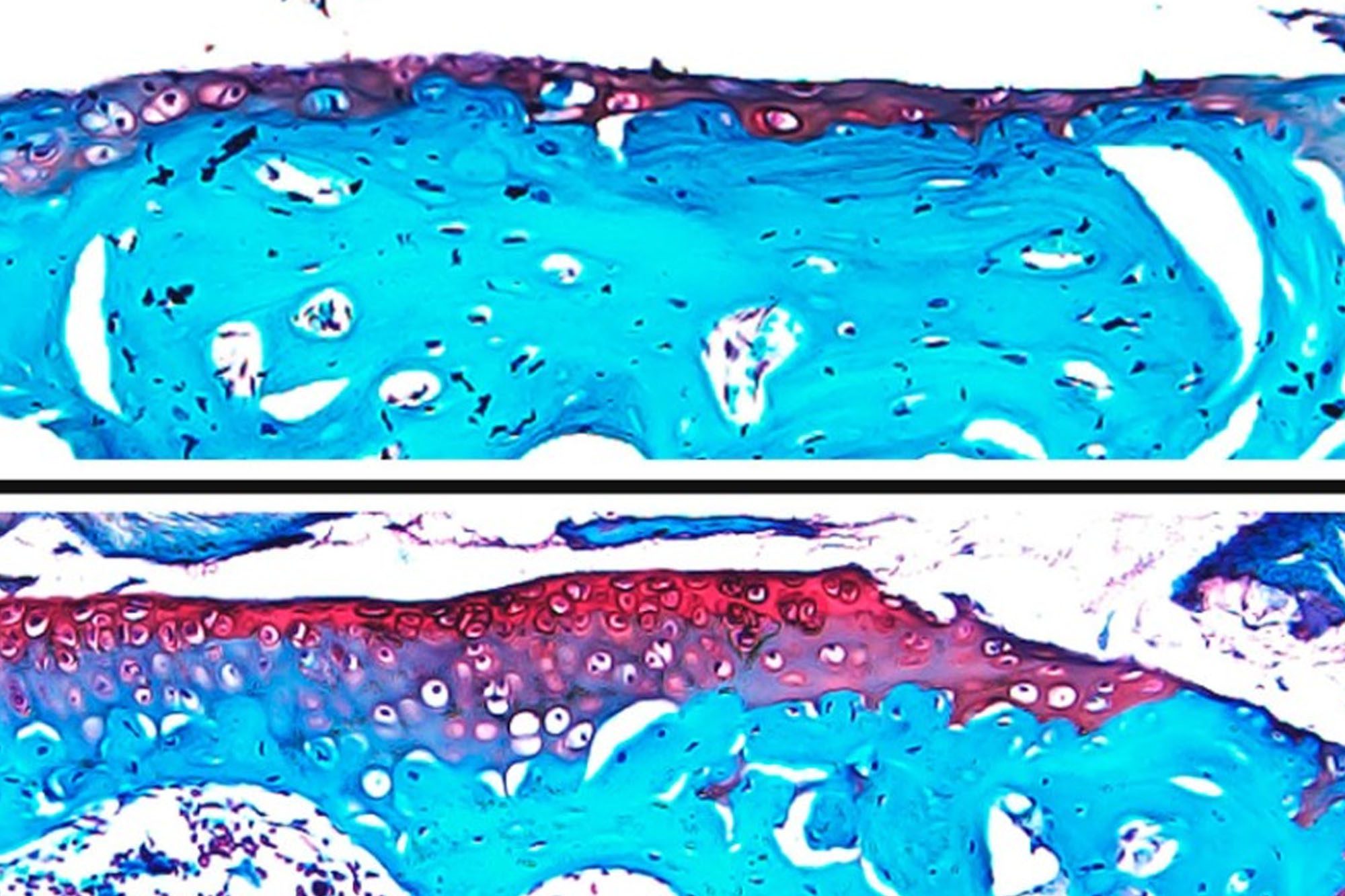 Research image of osteoarthritis cartilage damage after 6 weeks of daily loading and treatment compared to a non-loaded control knee with no cartilage damage present.