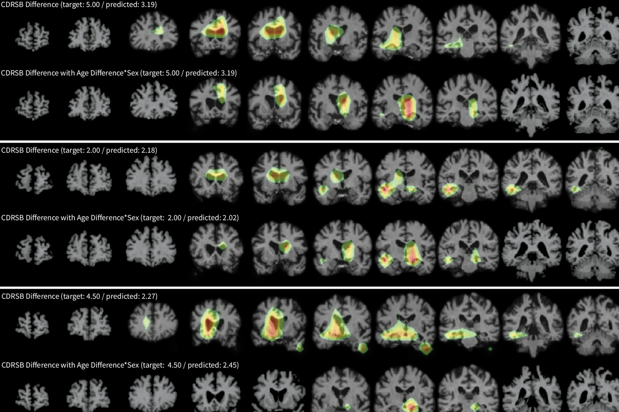 clinical biomedical imaging brain scan images